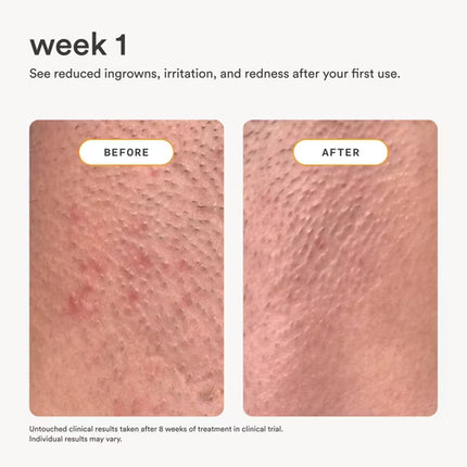Nood After Care Serum - 3.3 fl oz: Body Application, Liquid Form, Recommended For All Skin Types