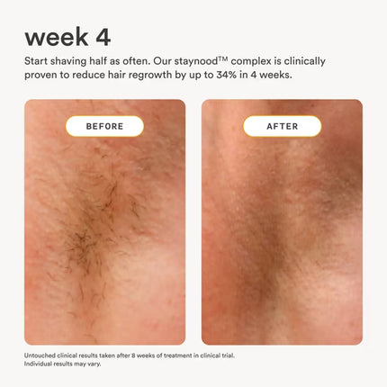 Nood After Care Serum - 3.3 fl oz: Body Application, Liquid Form, Recommended For All Skin Types